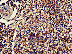 Immunohistochemistry of paraffin-embedded human spleen tissue using GZMK Antibody at dilution of 1:100Rabbit anti-Human GZMK Polyclonal Antibody
