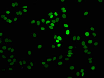 Immunofluorescence staining of HepG2 cells with Mono-methyl-H1F0 (K101) Antibody at 1:2.5, counter-stained with DAPI. The cells were fixed in 4% formaldehyde, permeabilized using 0.2% Triton X-100 and blocked in 10% normal Goat Serum. The cells were then incubated with the antibody overnight at 4°C. The secondary antibody was Alexa Fluor 488-congugated AffiniPure Goat Anti-Rabbit IgG(H+L).Rabbit anti-Human H1F0 Polyclonal Antibody
