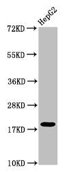 Western Blot  | Positive WB detected in: HepG2 whole cell lysate  | All lanes: H1F0 antibody at 1:50  | Secondary  | Goat polyclonal to rabbit IgG at 1/50000 dilution  | Predicted band size: 21, 20 kDa  | Observed band size: 21 kDaRabbit anti-Human H1F0 Polyclonal Antibody