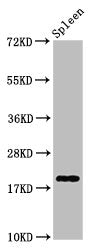 Western Blot  | Positive WB detected in: Rat spleen tissue  | All lanes: H1F0 antibody at 0.85μg/ml  | Secondary  | Goat polyclonal to rabbit IgG at 1/50000 dilution  | Predicted band size: 21, 20 kDa  | Observed band size: 21 kDaRabbit anti-Human H1F0 Polyclonal Antibody