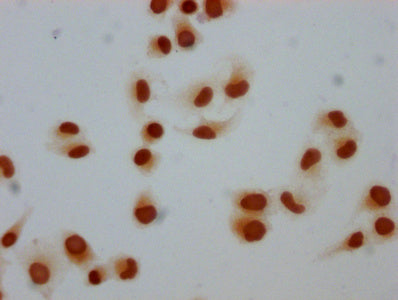 Immunocytochemistry analysis of Mono-methyl-H1F0 (K81) Antibody diluted at 1:5 and staining in Hela cells performed on a Leica BondTM system. The cells were fixed in 4% formaldehyde, permeabilized using 0.2% Triton X-100 and blocked with 10% normal goat serum 30min at RT. Then primary antibody (1% BSA) was incubated at 4°C overnight. The primary is detected by a biotinylated secondary antibody and visualized using an HRP conjugated SP system.Rabbit anti-Human H1F0 Polyclonal Antibody