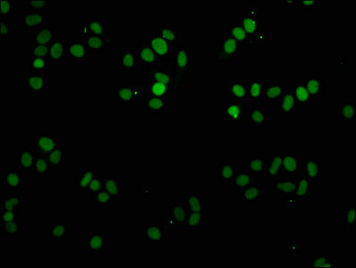 Immunofluorescence staining of HepG2 cells with the antibody at 1:2.5, counter-stained with DAPI. The cells were fixed in 4% formaldehyde, permeabilized using 0.2% Triton X-100 and blocked in 10% normal Goat Serum. The cells were then incubated with the antibody overnight at 4°C. The secondary antibody was Alexa Fluor 488-congugated AffiniPure Goat Anti-Rabbit IgG(H+L).Rabbit anti-Human H1F0 Polyclonal Antibody