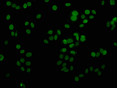 Immunofluorescence staining of HepG2 cells with H1F0 (Ab-81) Antibody at 1:2.5, counter-stained with DAPI. The cells were fixed in 4% formaldehyde, permeabilized using 0.2% Triton X-100 and blocked in 10% normal Goat Serum. The cells were then incubated with the antibody overnight at 4°C. The secondary antibody was Alexa Fluor 488-congugated AffiniPure Goat Anti-Rabbit IgG(H+L).Rabbit anti-Human H1F0 Polyclonal Antibody