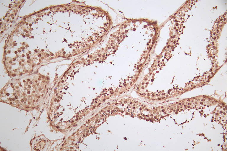 IHC image of H2AFJ Antibody diluted at 1:100 and staining in paraffin-embedded human testicular tissue performed on a Leica BondTM system. After dewaxing and hydration, antigen retrieval was mediated by high pressure in a citrate buffer (pH 6.0). Section was blocked with 10% normal goat serum 30min at RT. Then primary antibody (1% BSA) was incubated at 4°C overnight. The primary is detected by a biotinylated secondary antibody and visualized using an HRP conjugated SP system.Rabbit anti-Human H2AFJ Polyclonal Antibody