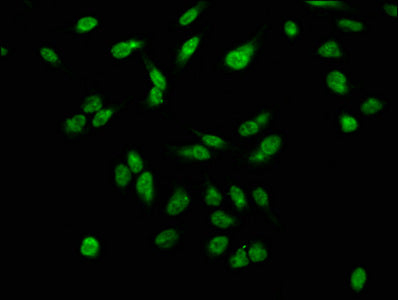Immunofluorescence staining of Hela cells with Phospho-H2AFX (S139) Antibody at 1:2.5, counter-stained with DAPI. The cells were fixed in 4% formaldehyde, permeabilized using 0.2% Triton X-100 and blocked in 10% normal Goat Serum. The cells were then incubated with the antibody overnight at 4°C. The secondary antibody was Alexa Fluor 488-congugated AffiniPure Goat Anti-Rabbit IgG(H+L).Rabbit anti-Human H2AFX Polyclonal Antibody