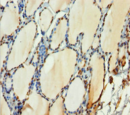 Immunohistochemistry of paraffin-embedded human thyroid tissue using H2AFY Antibody at dilution of 1:100Rabbit anti-Human H2AFY Polyclonal Antibody