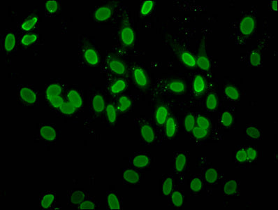 Immunofluorescence staining of Hela cells with Acetyl-H2AFZ (K4) Antibody at 1:10, counter-stained with DAPI. The cells were fixed in 4% formaldehyde, permeabilized using 0.2% Triton X-100 and blocked in 10% normal Goat Serum. The cells were then incubated with the antibody overnight at 4°C. The secondary antibody was Alexa Fluor 488-congugated AffiniPure Goat Anti-Rabbit IgG(H+L).Rabbit anti-Human H2AFZ Polyclonal Antibody
