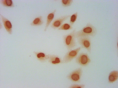 Immunocytochemistry analysis of Mono-methyl-H2AFZ (K4) Antibody diluted at 1:5 and staining in Hela cells performed on a Leica BondTM system. The cells were fixed in 4% formaldehyde, permeabilized using 0.2% Triton X-100 and blocked with 10% normal goat serum 30min at RT. Then primary antibody (1% BSA) was incubated at 4°C overnight. The primary is detected by a biotinylated secondary antibody and visualized using an HRP conjugated SP system.