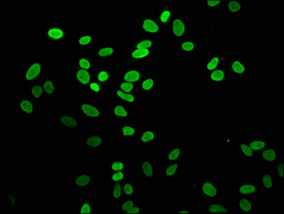 Immunofluorescence staining of Hela cells with the antibody at 1:5, counter-stained with DAPI. The cells were fixed in 4% formaldehyde, permeabilized using 0.2% Triton X-100 and blocked in 10% normal Goat Serum. The cells were then incubated with the antibody overnight at 4°C. The secondary antibody was Alexa Fluor 488-congugated AffiniPure Goat Anti-Rabbit IgG(H+L).