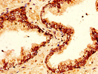 IHC image of H2AFZ (Ab-4) Antibody diluted at 1:50 and staining in paraffin-embedded human prostate tissue performed on a Leica BondTM system. After dewaxing and hydration, antigen retrieval was mediated by high pressure in a citrate buffer (pH 6.0). Section was blocked with 10% normal goat serum 30min at RT. Then primary antibody (1% BSA) was incubated at 4°C overnight. The primary is detected by a biotinylated secondary antibody and visualized using an HRP conjugated SP system.Rabbit anti-Human H2AFZ Polyclonal Antibody
