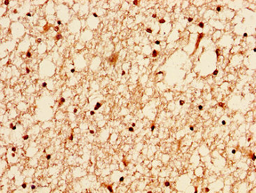 IHC image of H2AFZ (Ab-4) Antibody diluted at 1:50 and staining in paraffin-embedded human brain tissue performed on a Leica BondTM system. After dewaxing and hydration, antigen retrieval was mediated by high pressure in a citrate buffer (pH 6.0). Section was blocked with 10% normal goat serum 30min at RT. Then primary antibody (1% BSA) was incubated at 4°C overnight. The primary is detected by a biotinylated secondary antibody and visualized using an HRP conjugated SP system.Rabbit anti-Human H2AFZ Polyclonal Antibody