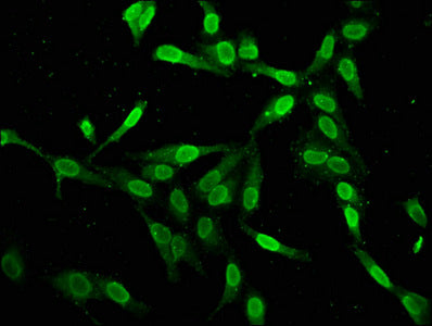 Immunofluorescence staining of Hela cells with H2AFZ (Ab-4) Antibody at 1:2.5, counter-stained with DAPI. The cells were fixed in 4% formaldehyde, permeabilized using 0.2% Triton X-100 and blocked in 10% normal Goat Serum. The cells were then incubated with the antibody overnight at 4°C. The secondary antibody was Alexa Fluor 488-congugated AffiniPure Goat Anti-Rabbit IgG(H+L).Rabbit anti-Human H2AFZ Polyclonal Antibody