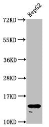 Western Blot  | Positive WB detected in: HepG2 whole cell lysate  | All lanes: H2AFZ antibody at 1.96µg/ml  | Secondary  | Goat polyclonal to rabbit IgG at 1/50000 dilution  | Predicted band size: 14 kDa  | Observed band size: 14 kDaRabbit anti-Human H2AFZ Polyclonal Antibody