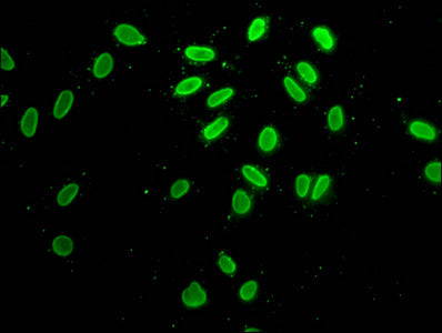 Immunofluorescence staining of Hela cells with Acetyl-H2AFZ (K7) Antibody at 1:25, counter-stained with DAPI. The cells were fixed in 4% formaldehyde, permeabilized using 0.2% Triton X-100 and blocked in 10% normal Goat Serum. The cells were then incubated with the antibody overnight at 4°C. The secondary antibody was Alexa Fluor 488-congugated AffiniPure Goat Anti-Rabbit IgG(H+L).Rabbit anti-Human H2AFZ Polyclonal Antibody