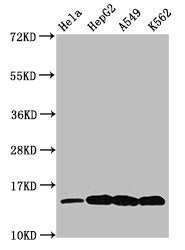 Western Blot  | Positive WB detected in: Hela whole cell lysate, HepG2 whole cell lysate, A549 whole cell lysate, K562 whole cell lysate (All treated by 30mM sodium butyrate for 4h)  | All lanes: H2AFZ antibody at 0.48µg/ml  | Secondary  | Goat polyclonal to rabbit IgG at 1/50000 dilution  | Predicted band size: 14 kDa  | Observed band size: 14 kDaRabbit anti-Human H2AFZ Polyclonal Antibody