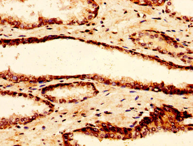 IHC image of H2AFZ (Ab-7) Antibody diluted at 1:50 and staining in paraffin-embedded human prostate tissue performed on a Leica BondTM system. After dewaxing and hydration, antigen retrieval was mediated by high pressure in a citrate buffer (pH 6.0). Section was blocked with 10% normal goat serum 30min at RT. Then primary antibody (1% BSA) was incubated at 4°C overnight. The primary is detected by a biotinylated secondary antibody and visualized using an HRP conjugated SP system.Rabbit anti-Human H2AFZ Polyclonal Antibody
