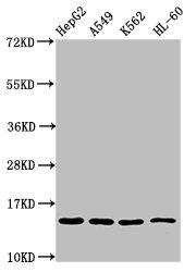 Western Blot  | Positive WB detected in: HepG2 whole cell lysate, A549 whole cell lysate, K562 whole cell lysate, HL60 whole cell lysate  | All lanes: H2AFZ antibody at 0.8µg/ml  | Secondary  | Goat polyclonal to rabbit IgG at 1/50000 dilution  | Predicted band size: 14 kDa  | Observed band size: 14 kDaRabbit anti-Human H2AFZ Polyclonal Antibody