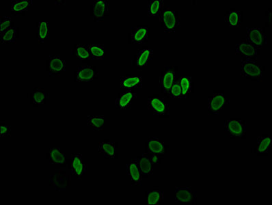 Immunofluorescent analysis of Hela cells (sodium butyrate, 30 mM, 4h) using the antibody at dilution of 1:100 and Alexa Fluor 488-congugated AffiniPure Goat Anti-Rabbit IgG(H+L)Rabbit anti-Human H2AFZ Polyclonal Antibody