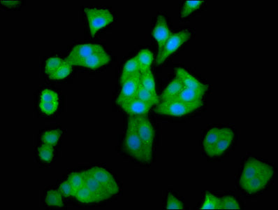 Immunofluorescence staining of HepG2 cells with HAL Antibody at 1:66, counter-stained with DAPI. The cells were fixed in 4% formaldehyde, permeabilized using 0.2% Triton X-100 and blocked in 10% normal Goat Serum. The cells were then incubated with the antibody overnight at 4°C. The secondary antibody was Alexa Fluor 488-congugated AffiniPure Goat Anti-Rabbit IgG(H+L).Rabbit anti-Human HAL Polyclonal Antibody