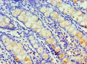 Immunohistochemistry of paraffin-embedded human colon tissue using HARS Antibody at dilution of 1:100Rabbit anti-Human HARS Polyclonal Antibody
