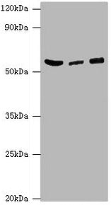Western blot | All lanes: HARS antibody at 6μg/ml | Lane 1: Hela whole cell lysate | Lane 2: K562 whole cell lysate | Lane 3: 293T whole cell lysate | Secondary | Goat polyclonal to rabbit IgG at 1/10000 dilution | Predicted band size: 58, 53, 51, 55 kDa | Observed band size: 58 kDaRabbit anti-Human HARS Polyclonal Antibody