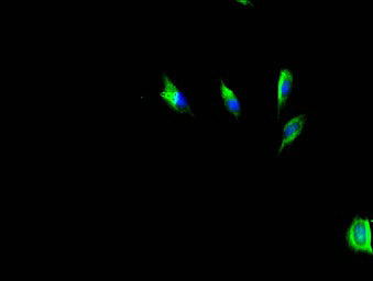 Immunofluorescent analysis of U251 cells using HAS3 Antibody at dilution of 1:100 and Alexa Fluor 488-congugated AffiniPure Goat Anti-Rabbit IgG(H+L)Rabbit anti-Human HAS3 Polyclonal Antibody