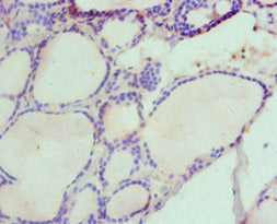 Immunohistochemistry of paraffin-embedded human thyroid tissue using the antibody at dilution of 1:100Rabbit anti-Human HAS3 Polyclonal Antibody