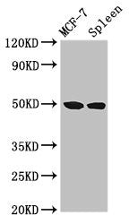 Western Blot  | Positive WB detected in: MCF-7 whole cell lysate, Rat spleen tissue  | All lanes: HAT1 antibody at 3µg/ml  | Secondary  | Goat polyclonal to rabbit IgG at 1/50000 dilution  | Predicted band size: 50, 40 kDa  | Observed band size: 50 kDaRabbit anti-Human HAT1 Polyclonal Antibody