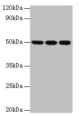 Western blot  | All lanes: HAT1 antibody at 3µg/ml  | Lane 1: MCF-7 whole cell lysate  | Lane 2: 293T whole cell lysate  | Lane 3: HepG2 whole cell lysate  | Secondary  | Goat polyclonal to rabbit at 1/10000 dilution  | Predicted band size: 50, 40 kDa  | Observed band size: 50 kDaRabbit anti-Human HAT1 Polyclonal Antibody