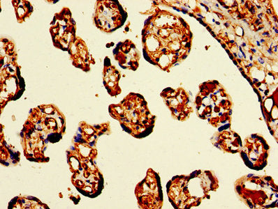IHC image of HBB Antibody diluted at 1:300 and staining in paraffin-embedded human placenta tissue performed on a Leica BondTM system. After dewaxing and hydration, antigen retrieval was mediated by high pressure in a citrate buffer (pH 6.0). Section was blocked with 10% normal goat serum 30min at RT. Then primary antibody (1% BSA) was incubated at 4°C overnight. The primary is detected by a biotinylated secondary antibody and visualized using an HRP conjugated SP system.Rabbit anti-Human HBB Polyclonal Antibody