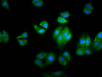 Immunofluorescence staining of HepG2 cells with HBG2 Antibody at 1:100, counter-stained with DAPI. The cells were fixed in 4% formaldehyde, permeabilized using 0.2% Triton X-100 and blocked in 10% normal Goat Serum. The cells were then incubated with the antibody overnight at 4°C. The secondary antibody was Alexa Fluor 488-congugated AffiniPure Goat Anti-Rabbit IgG(H+L).Rabbit anti-Human HBG2 Polyclonal Antibody