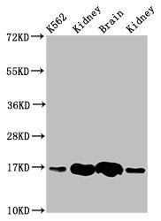 Western Blot  | Positive WB detected in: K562 whole cell lysate, Rat kideny tissue, Rat brain tissue, Mouse kidney tissue  | All lanes: HBG2 antibody at 4.6µg/ml  | Secondary  | Goat polyclonal to rabbit IgG at 1/50000 dilution  | Predicted band size: 17 kDa  | Observed band size: 17 kDaRabbit anti-Human HBG2 Polyclonal Antibody