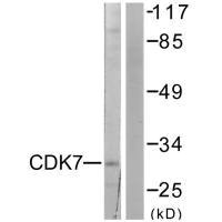 Western blot analysis of extracts from 293 cells, using CDK7 antibody.Rabbit anti-Human CDK7 Polyclonal Antibody