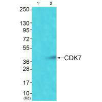 Western blot analysis of extracts from Colo cells using CDK7 antibody. The lane on the left is treated with synthesized peptide.Rabbit anti-Human CDK7 Polyclonal Antibody