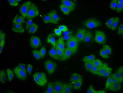 Immunofluorescence staining of HepG2 cells with HCN1 Antibody at 1:166, counter-stained with DAPI. The cells were fixed in 4% formaldehyde, permeabilized using 0.2% Triton X-100 and blocked in 10% normal Goat Serum. The cells were then incubated with the antibody overnight at 4°C. The secondary antibody was Alexa Fluor 488-congugated AffiniPure Goat Anti-Rabbit IgG(H+L).Rabbit anti-Human HCN1 Polyclonal Antibody