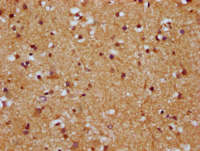 IHC image of HCN1 Antibody diluted at 1:500 and staining in paraffin-embedded human brain tissue performed on a Leica BondTM system. After dewaxing and hydration, antigen retrieval was mediated by high pressure in a citrate buffer (pH 6.0). Section was blocked with 10% normal goat serum 30min at RT. Then primary antibody (1% BSA) was incubated at 4°C overnight. The primary is detected by a biotinylated secondary antibody and visualized using an HRP conjugated SP system.Rabbit anti-Human HCN1 Polyclonal Antibody