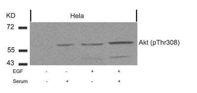 Western blot analysis of extracts from Hela cells untreated or treated with EGF, serum or both using Akt(Phospho-Thr308) Antibody.Rabbit anti-Human AKT1 Polyclonal Antibody