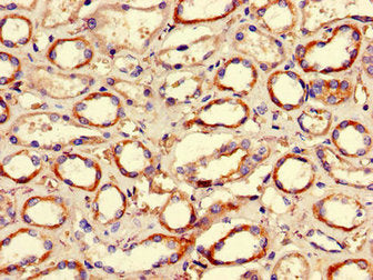 Immunohistochemistry of paraffin-embedded human kidney tissue using HDAC10 Antibody at dilution of 1:100Rabbit anti-Human HDAC10 Polyclonal Antibody