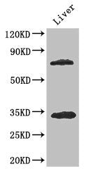 Western Blot | Positive WB detected in: Mouse liver tissue | All lanes: HDAC10 antibody at 3.4μg/ml | Secondary | Goat polyclonal to rabbit IgG at 1/50000 dilution | Predicted band size: 72, 70, 71, 44 kDa | Observed band size: 72, 34 kDaRabbit anti-Human HDAC10 Polyclonal Antibody