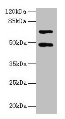 Western blot  | All lanes: HDAC3 antibody at 2µg/ml + Hela whole cell lysate  | Secondary  | Goat polyclonal to rabbit IgG at 1/10000 dilution  | Predicted band size: 49, 50 kDa  | Observed band size: 49 kDaRabbit anti-Human HDAC3 Polyclonal Antibody