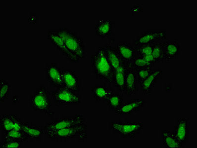 Immunofluorescent analysis of Hela cells using HDAC8 Antibody at dilution of 1:100 and Alexa Fluor 488-congugated AffiniPure Goat Anti-Rabbit IgG(H+L)Rabbit anti-Human HDAC8 Polyclonal Antibody