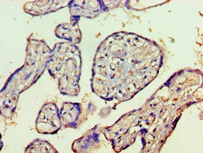 Immunohistochemistry of paraffin-embedded human placenta tissue using the antibody at dilution of 1:100Rabbit anti-Human HDAC8 Polyclonal Antibody