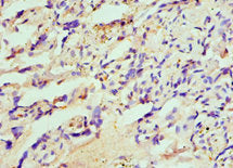 Immunohistochemistry of paraffin-embedded human placenta tissue using HIP1 Antibody at dilution of 1:100Rabbit anti-Human HIP1 Polyclonal Antibody