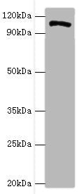 Western blot | All lanes: HIP1 antibody at 4μg/ml + A549 whole cell lysate | Secondary | Goat polyclonal to rabbit IgG at 1/10000 dilution | Predicted band size: 117, 111, 114 kDa | Observed band size: 117 kDaRabbit anti-Human HIP1 Polyclonal Antibody
