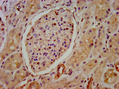 IHC image of HIP1R Antibody diluted at 1:800 and staining in paraffin-embedded human kidney tissue performed on a Leica BondTM system. After dewaxing and hydration, antigen retrieval was mediated by high pressure in a citrate buffer (pH 6.0). Section was blocked with 10% normal goat serum 30min at RT. Then primary antibody (1% BSA) was incubated at 4°C overnight. The primary is detected by a biotinylated secondary antibody and visualized using an HRP conjugated SP system.Rabbit anti-Human HIP1R Polyclonal Antibody