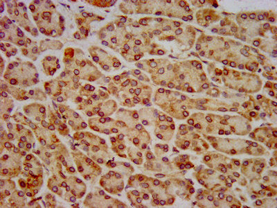 IHC image of HIP1R Antibody diluted at 1:800 and staining in paraffin-embedded human pancreatic tissue performed on a Leica BondTM system. After dewaxing and hydration, antigen retrieval was mediated by high pressure in a citrate buffer (pH 6.0). Section was blocked with 10% normal goat serum 30min at RT. Then primary antibody (1% BSA) was incubated at 4°C overnight. The primary is detected by a biotinylated secondary antibody and visualized using an HRP conjugated SP system.Rabbit anti-Human HIP1R Polyclonal Antibody
