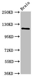 Western Blot | Positive WB detected in: Rat brain tissue | All lanes: HIP1R antibody at 2.4μg/ml | Secondary | Goat polyclonal to rabbit IgG at 1/50000 dilution | Predicted band size: 120, 71 kDa | Observed band size: 120 kDaRabbit anti-Human HIP1R Polyclonal Antibody