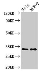 Western Blot  | Positive WB detected in: Hela whole cell lysate, MCF-7 whole cell lysate  | All lanes: HIST1H1B antibody at 1.5µg/ml  | Secondary  | Goat polyclonal to rabbit IgG at 1/50000 dilution  | Predicted band size: 23 kDa  | Observed band size: 32 kDaRabbit anti-Human HIST1H1B Polyclonal Antibody