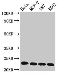 Western Blot  | Positive WB detected in: Hela whole cell lysate, MCF-7 whole cell lysate, U87 whole cell lysate, K562 whole cell lysate  | All lanes: HIST1H1B antibody at 1µg/ml  | Secondary  | Goat polyclonal to rabbit IgG at 1/50000 dilution  | Predicted band size: 23 kDa  | Observed band size: 23 kDaRabbit anti-Human HIST1H1B Polyclonal Antibody