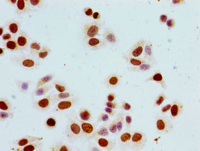 Immunocytochemistry analysis of HepG2 cells using Phospho-HIST1H1B (S17) Antibody at dilution of 1:100Rabbit anti-Human HIST1H1B Polyclonal Antibody